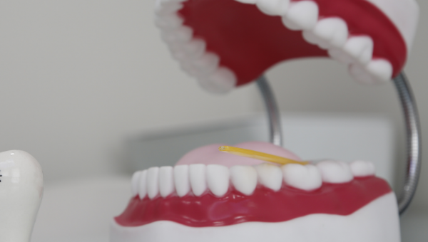 أرخص عيادة أسنان في مسقط